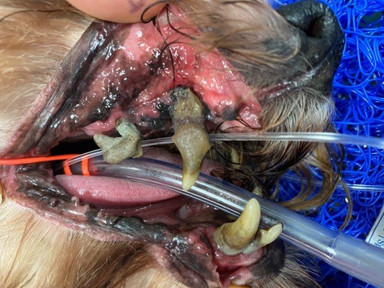 Dental Disease Treatment