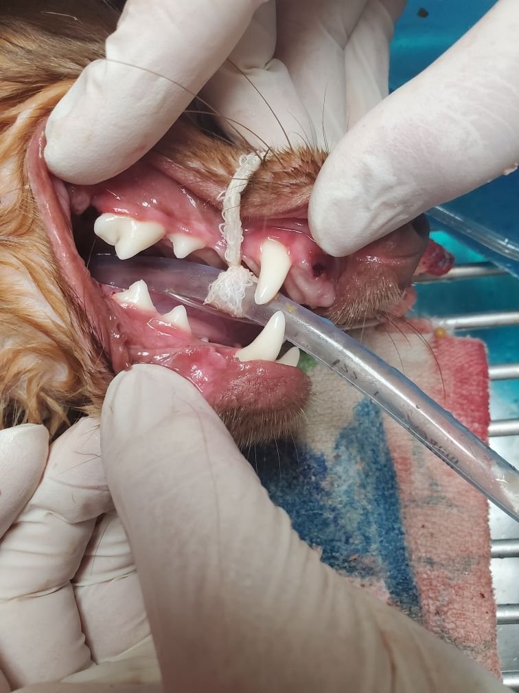Teeth Cleaning