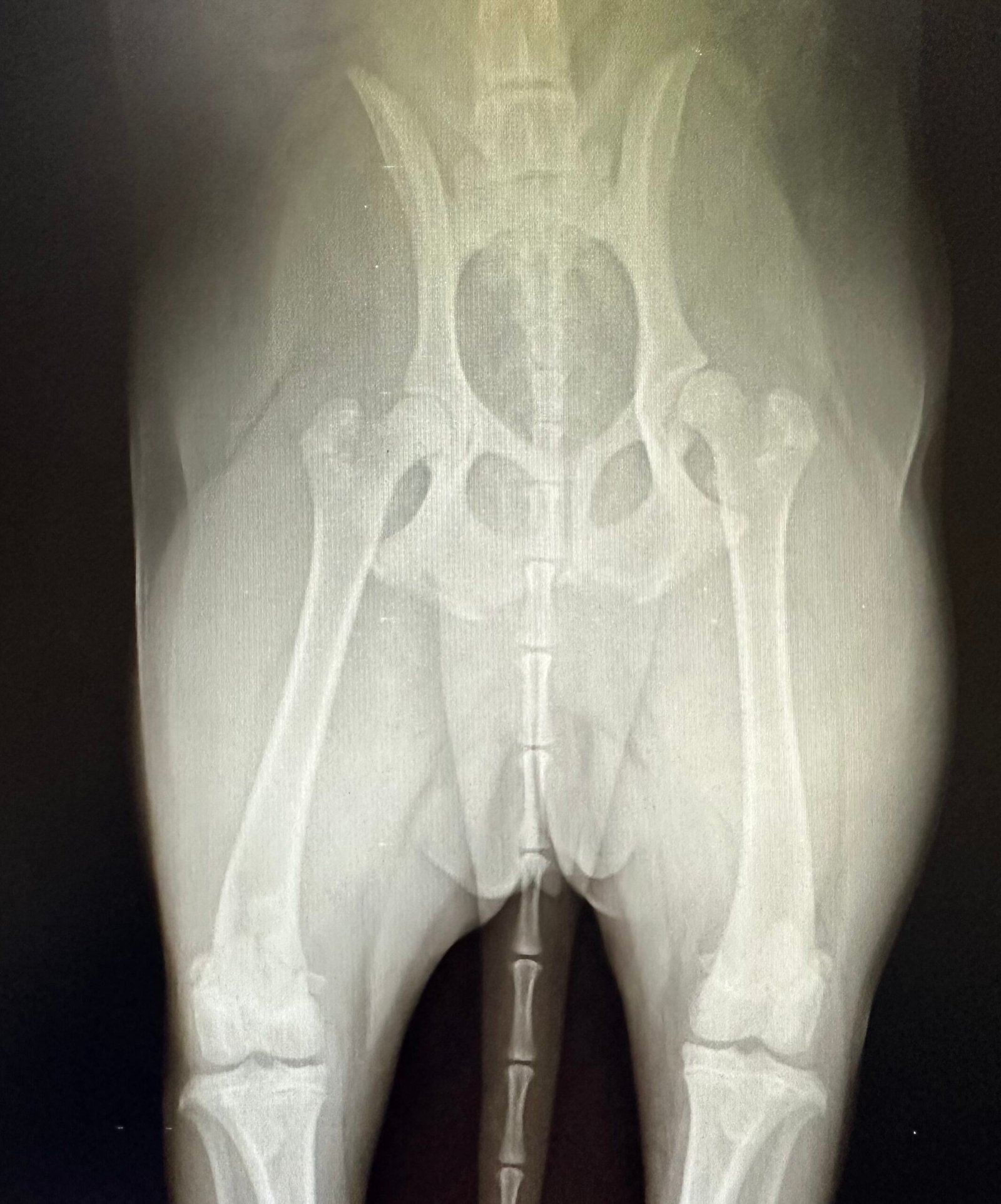 Radiograph