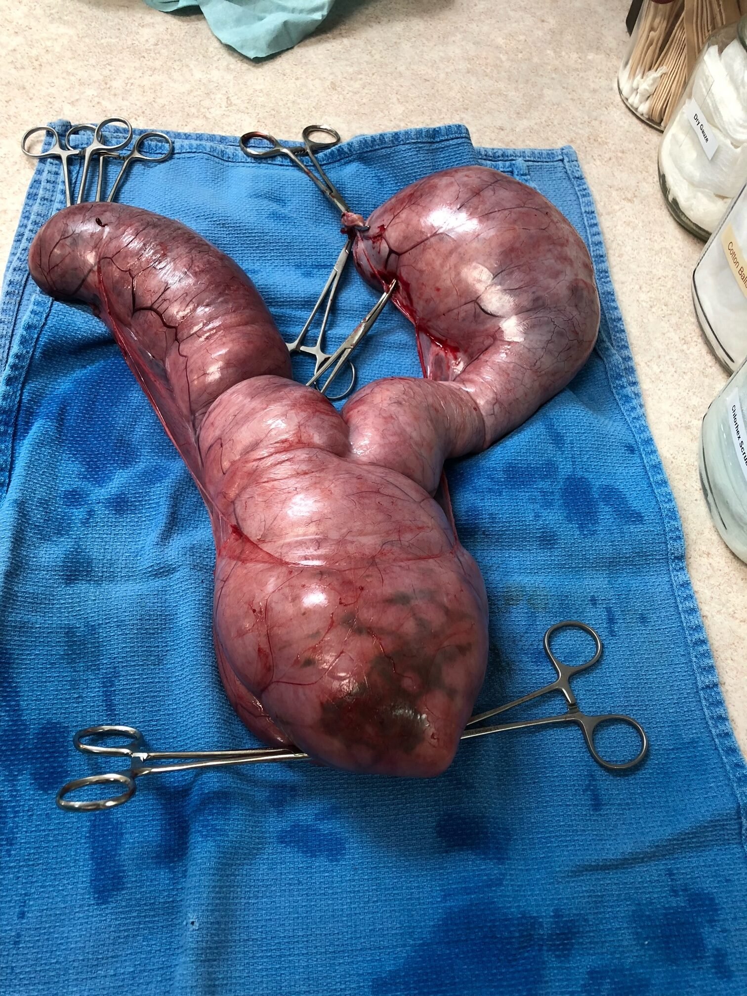Pyometra