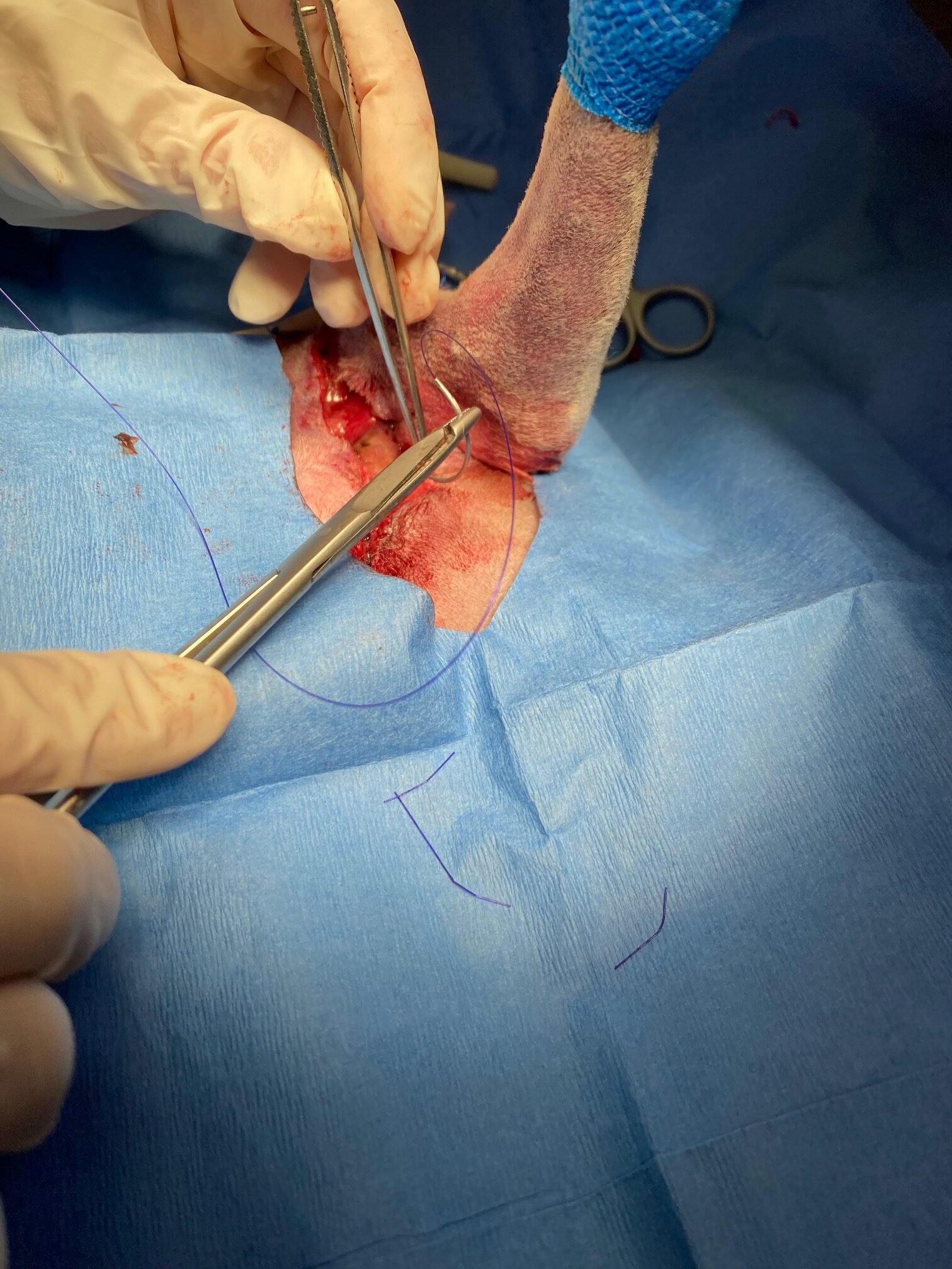 Sutures