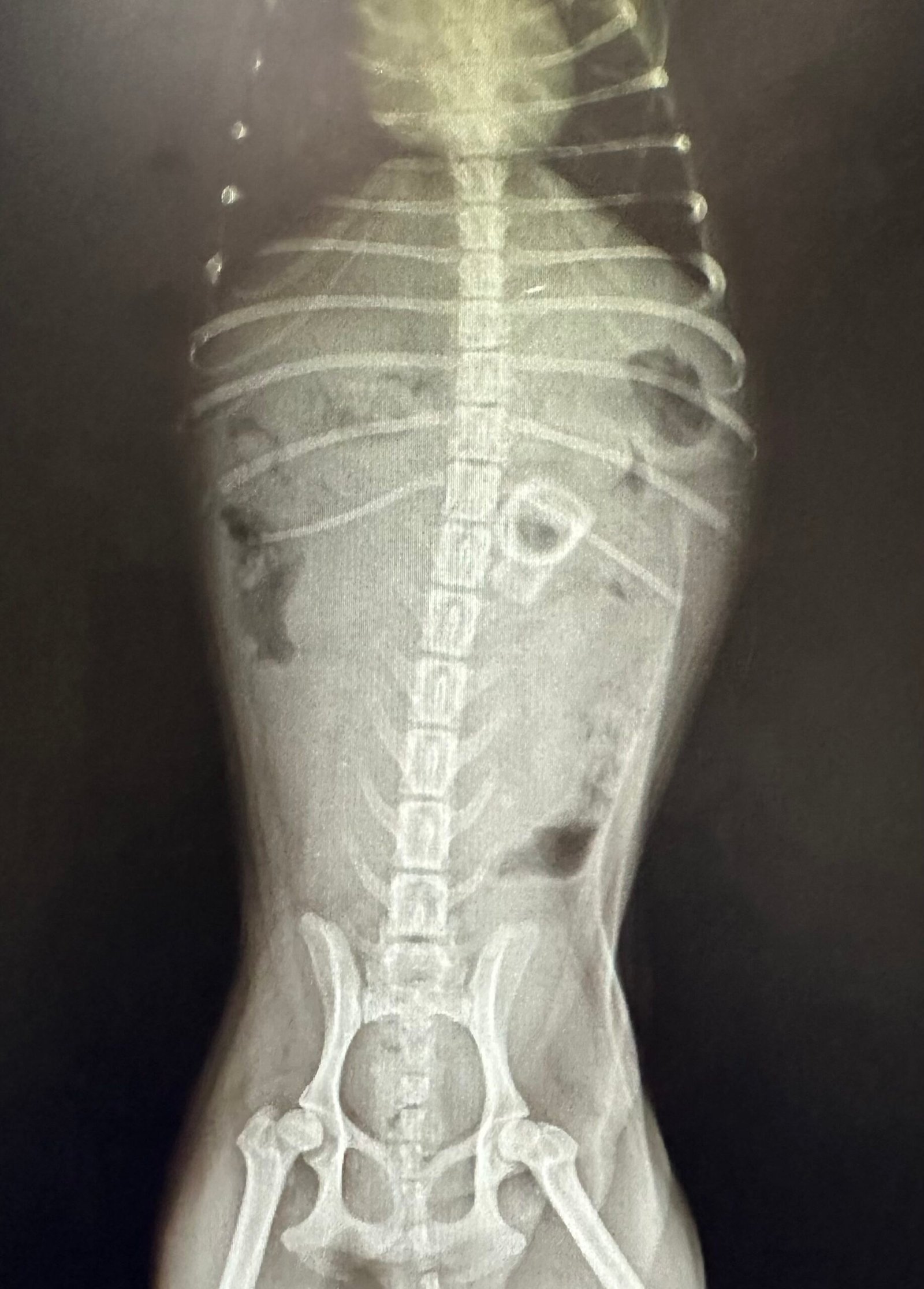 Radiograph